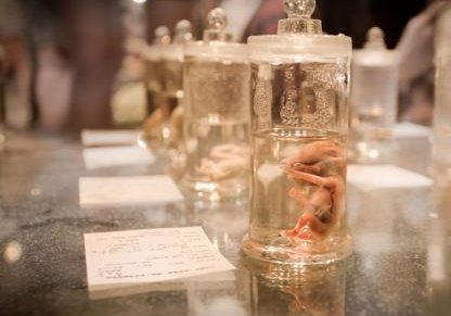 2026在监利市做基因检测多少钱？基因筛查可以规避哪些遗传病？